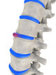 Spinal Disks Wall Decal