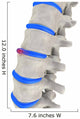 Spinal Disks Wall Decal