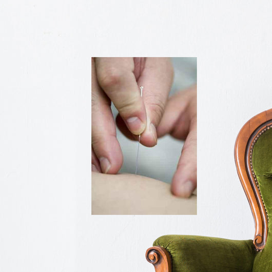 treatment by acupuncture Wall Mural