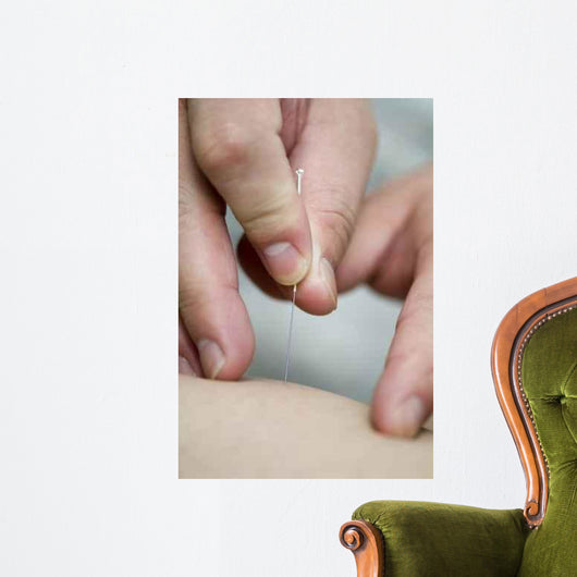 treatment by acupuncture Wall Mural
