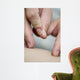 treatment by acupuncture Wall Mural