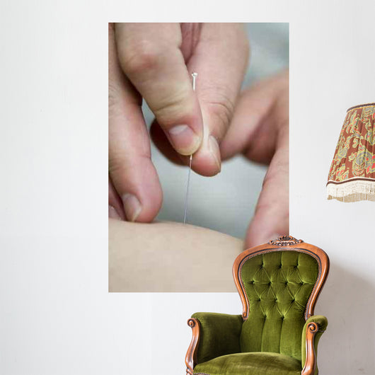 treatment by acupuncture Wall Mural