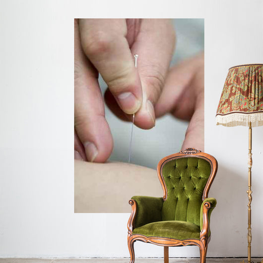 treatment by acupuncture Wall Mural