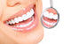 Healthy Teeth Wall Decal