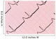Ecg Graph