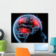 Headache Migraine Wall Mural