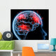 Headache Migraine Wall Mural