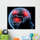 Headache Migraine Wall Mural