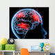 Headache Migraine Wall Mural