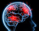 Headache Migraine Wall Mural