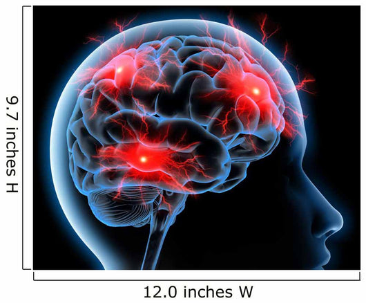 Headache Migraine Wall Mural