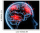 Headache Migraine Wall Mural