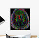 Brain Mri Wall Mural