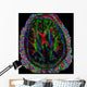Brain Mri Wall Mural