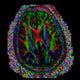 brain mri Wall Mural