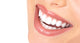 teeth and smile Wall Decal