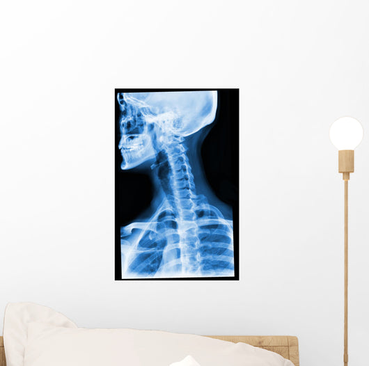 Blue Xray Wall Mural