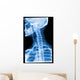 Blue Xray Wall Mural