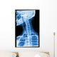 Blue Xray Wall Mural