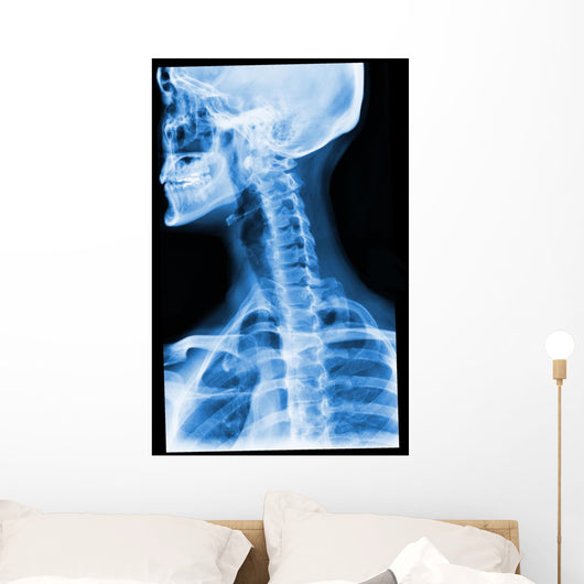 Blue Xray Wall Mural