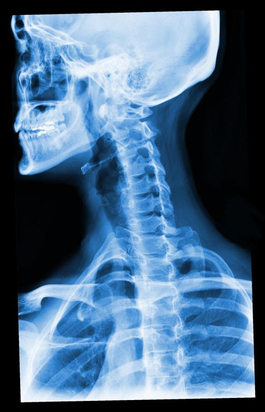 Blue Xray Wall Mural