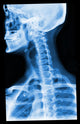 Blue Xray Wall Mural