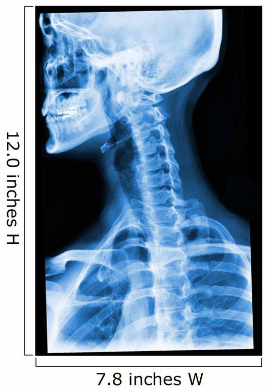 Blue Xray Wall Mural