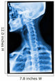 Blue Xray Wall Mural