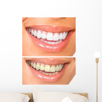 Healthy Teeth shown on a wall
