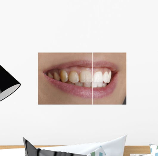 Quot White Teeth Quot