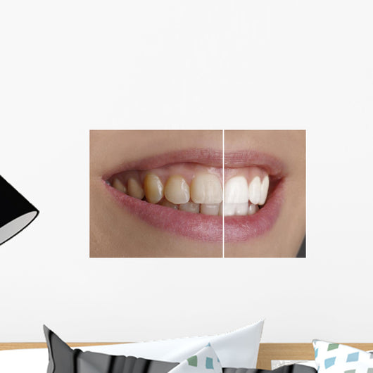 Quot White Teeth Quot