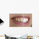 Quot White Teeth Quot