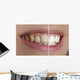 Quot White Teeth Quot