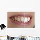 Quot White Teeth Quot