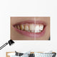 Quot White Teeth Quot
