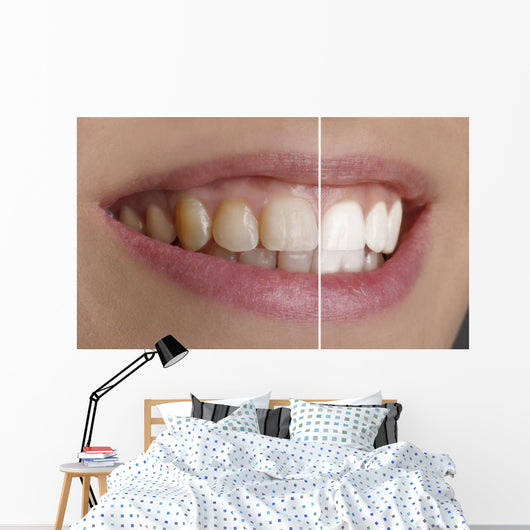 Quot White Teeth Quot