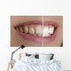 Quot White Teeth Quot