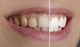 Quot White Teeth Quot