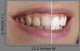 Quot White Teeth Quot