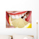 Smile and Bite with
