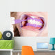 Cosmetic Dental Cleaning Protective
