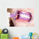 Cosmetic Dental Cleaning Protective