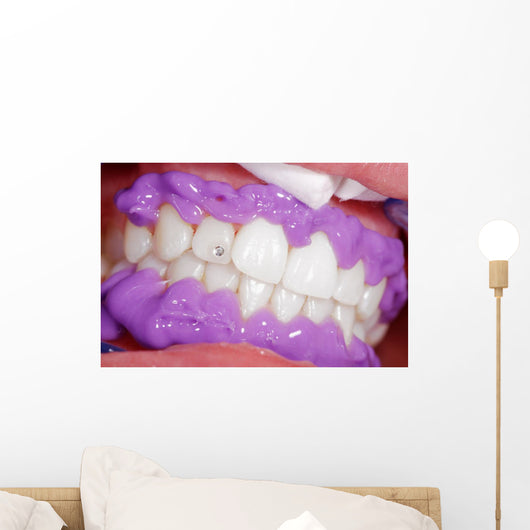 Cosmetic dental cleaning Wall Mural