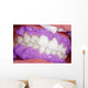 Cosmetic dental cleaning Wall Mural