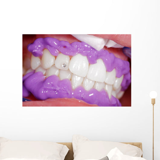 Cosmetic dental cleaning Wall Mural