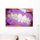 Cosmetic dental cleaning Wall Mural