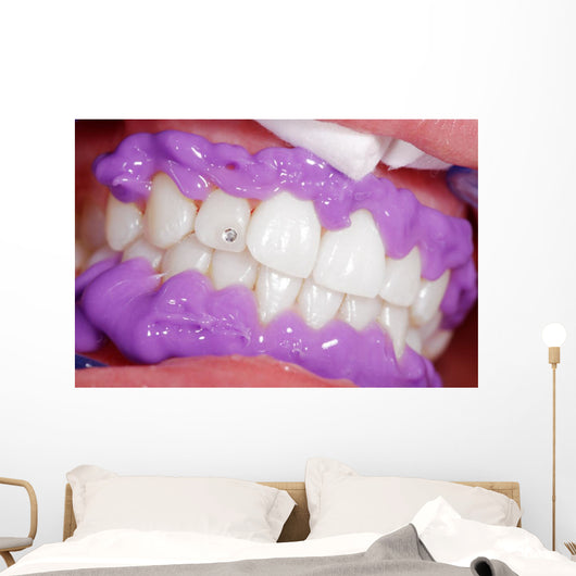 Cosmetic dental cleaning Wall Mural
