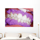 Cosmetic dental cleaning Wall Mural