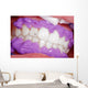 Cosmetic dental cleaning Wall Mural