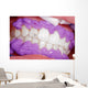 Cosmetic dental cleaning Wall Mural
